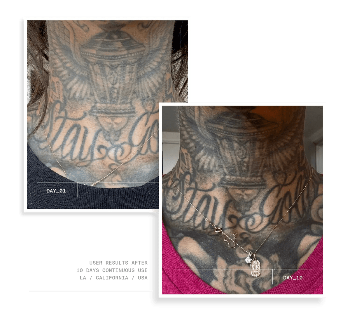 #270004,270006